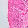 Epithelium
