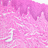 B3, Esophagus, 20x (H&E)