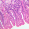 B10, Pyloroduodenal Junction, 20x (H&E)