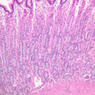 B5, Stomach (Corpus), 10x (H&E)