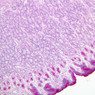 B6, Stomach (Corpus), 10x (PAS)