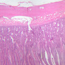 B15, Jejunum, 2.5x (H&E)