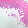 B16, Ileum, 2.5x (H&E)
