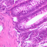 B23, Colon, 40x (H&E)