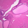 B54, Ovary, 1x (H&E)