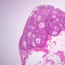 B94, Ovary, 1x (H&E)