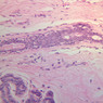 A93, Mammary Gland (Inactive), 20x (H&E)