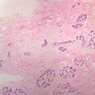 A93, Mammary Gland (Inactive), 2.5x (H&E)