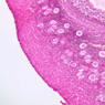 B96, Ovary, 10x (H&E)
