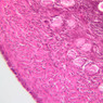 B96, Ovary, 20x (H&E)