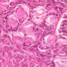 B96, Ovary, 40x (H&E)