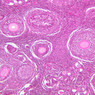 B94, Ovary, 10x (H&E)