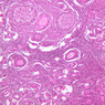 B94, Ovary, 10x (H&E)