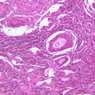 B94, Ovary, 20x (H&E)