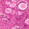 B96, Ovary, 40x (H&E)