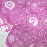 B94, Ovary, 2.5x (H&E)