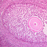 B94, Ovary, 20x (H&E)