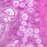 B96, Ovary, 20x (H&E)