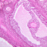 B96, Ovary, 10x (H&E)