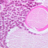 B94, Ovary, 40x (H&E)