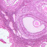 B94, Ovary, 10x (H&E)