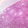B94, Ovary, 2.5x (H&E)