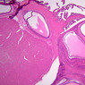 B54, Ovary, 1x (H&E)