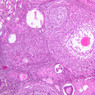 B94, Ovary, 10x (H&E)