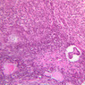 B94, Ovary, 20x (H&E)