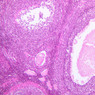 B94, Ovary, 10x (H&E)