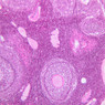 B94, Ovary, 10x (H&E)