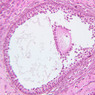 B95, Ovary, 20x (H&E)