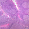 A41, Tonsil, 2.5x (Reticulin-H&E)