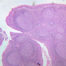 A41, Tonsil, 2.5x (Reticulin-H&E)