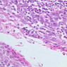 A41, Tonsil, 40x (Reticulin-H&E)