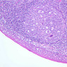 A41, Tonsil, 10x (Reticulin-H&E)