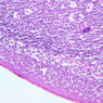 A41, Tonsil, 20x (Reticulin-H&E)