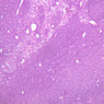 A32, Lymph Node, 10x (H&E)