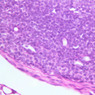 A32, Lymph Node, 40x (H&E)
