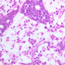 A32, Lymph Node, 40x (H&E)