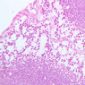 A32, Lymph Node, 20x (H&E)