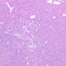 A32, Lymph Node, 20x (H&E)