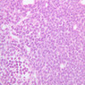 A32, Lymph Node, 40x (H&E)