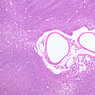 A32, Lymph Node, 10x (H&E)