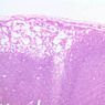 A32, Lymph Node, 10x (H&E)