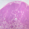 A32, Lymph Node, 2.5x (H&E)
