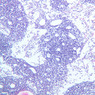 A33, Lymph Node, 10x (H&E)