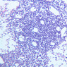 A33, Lymph Node, 20x (H&E)