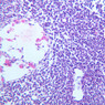 A33, Lymph Node, 20x (H&E)