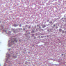 A34, Lymph Node, 20x (Reticulin)